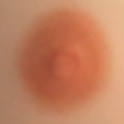 Light Brown Areolas